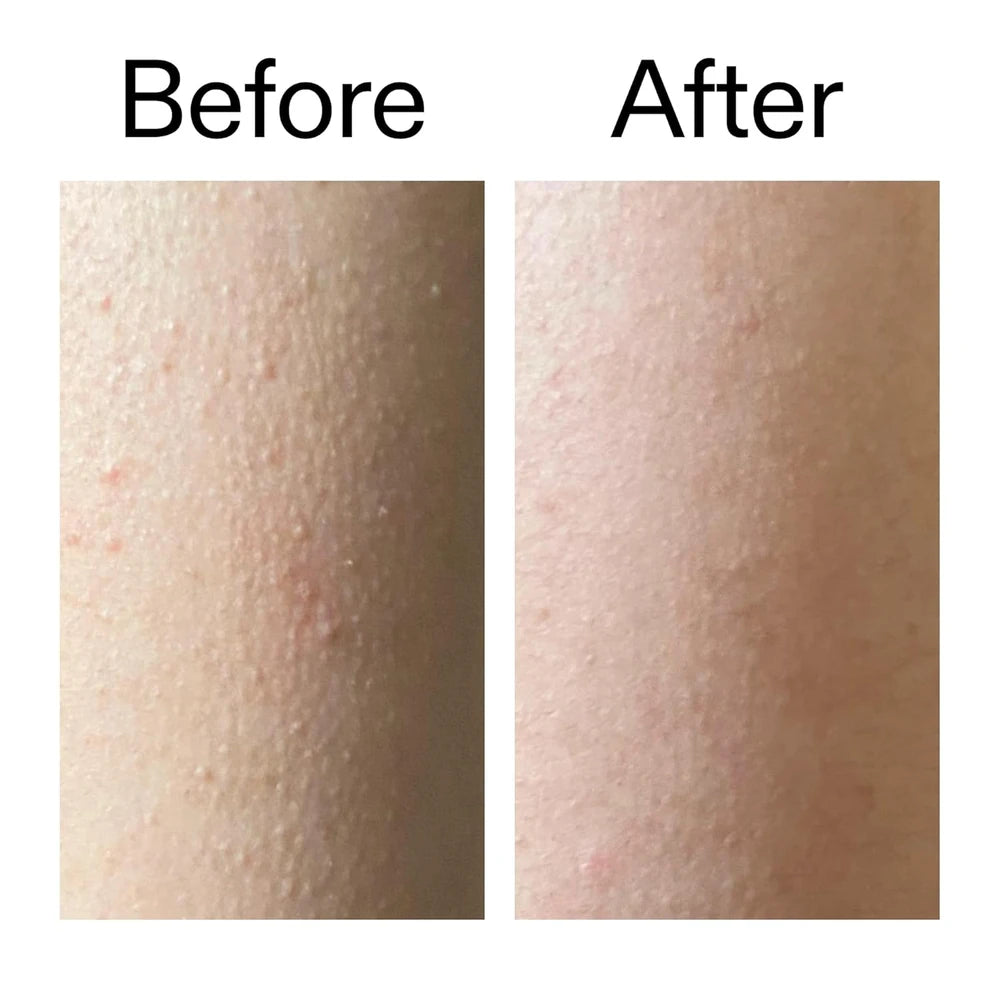 Glycolic Acid Exfoliating Body Stick